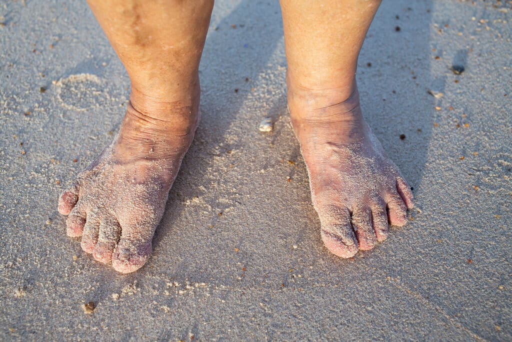 Personal care at home can help seniors keep their feet heathly for summer.